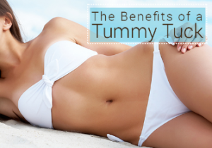 The Benefits of a Tummy Tuck