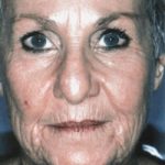 an image of a granny before undergoing a facelift