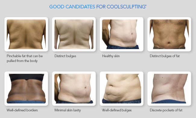 coolsculpting2