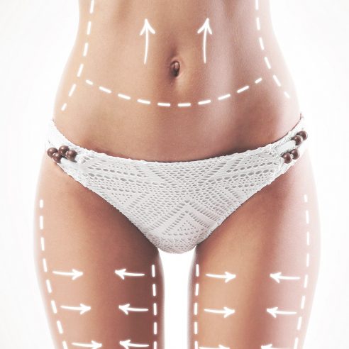 Liposuction surgery at Kole Plastic Surgery
