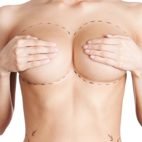 breast augmentation at Kole Plastic Surgery