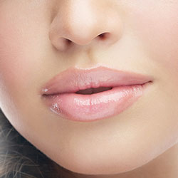 lip augmentation by Kole Plastic Surgery