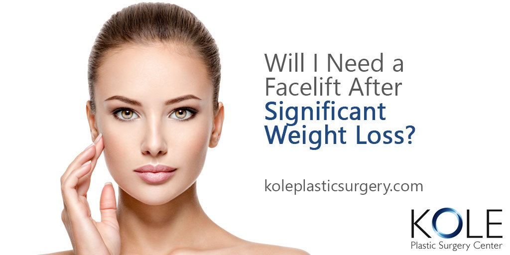 Will I need a facelift after significant weight loss?