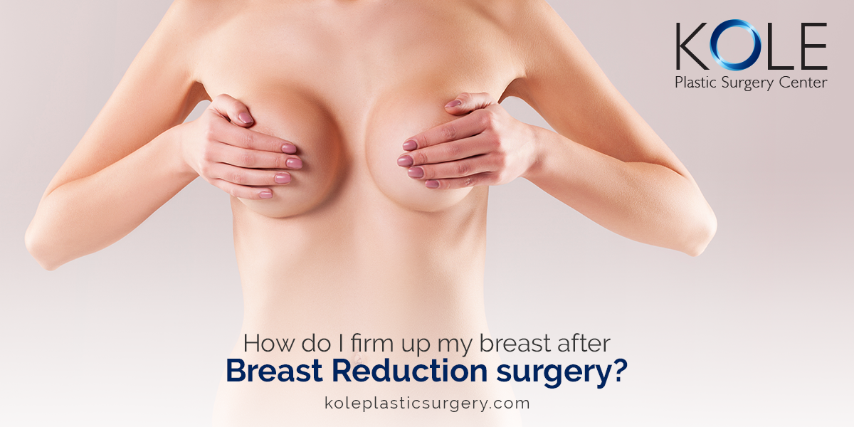 Breast Reduction Before and After: The Procedure, Insurance Coverage, and  Recovery