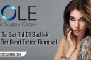 How To Get Rid Of Bad Ink And Get Great Tattoo Removal