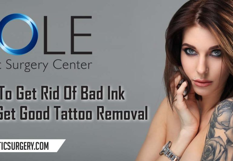 How To Get Rid Of Bad Ink And Get Great Tattoo Removal