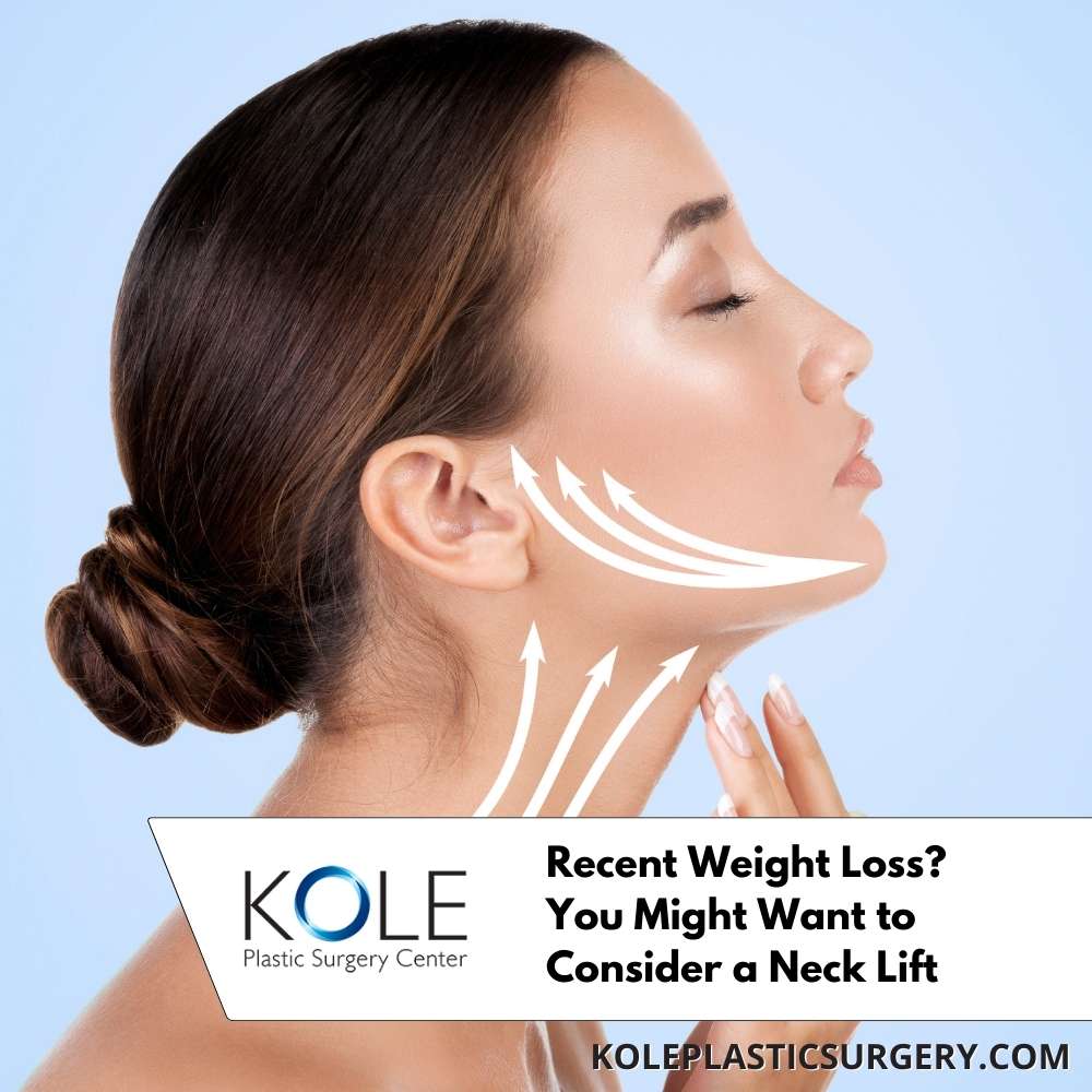 Recent Weight Loss? You Might Want to Consider a Neck Lift
