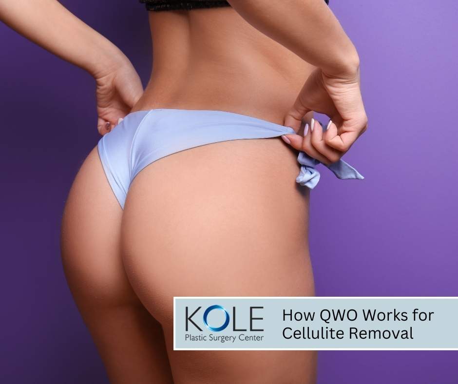 How QWO Works for Cellulite Removal