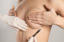 Breast Augmentation Kole Plastic Surgery Bucks County PA