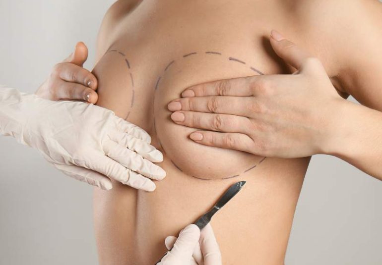 Breast Augmentation Kole Plastic Surgery Bucks County PA
