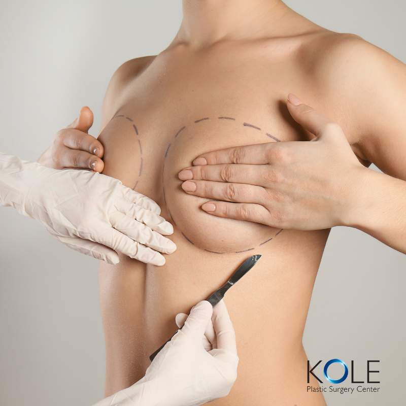 Breast Augmentation Kole Plastic Surgery Bucks County PA