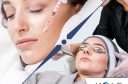 Laser Treatment vs Injectables - Kole Plastic Surgery Bucks County