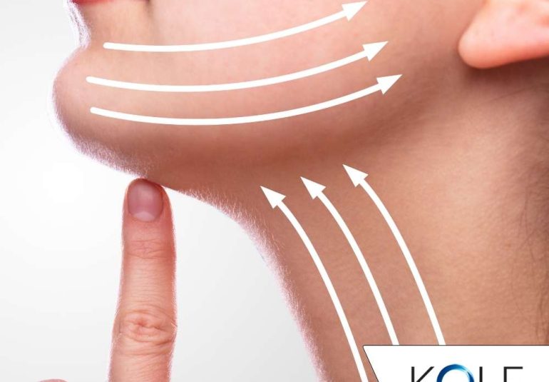 Neck Lift - Kole Plastic Surgery Bucks County