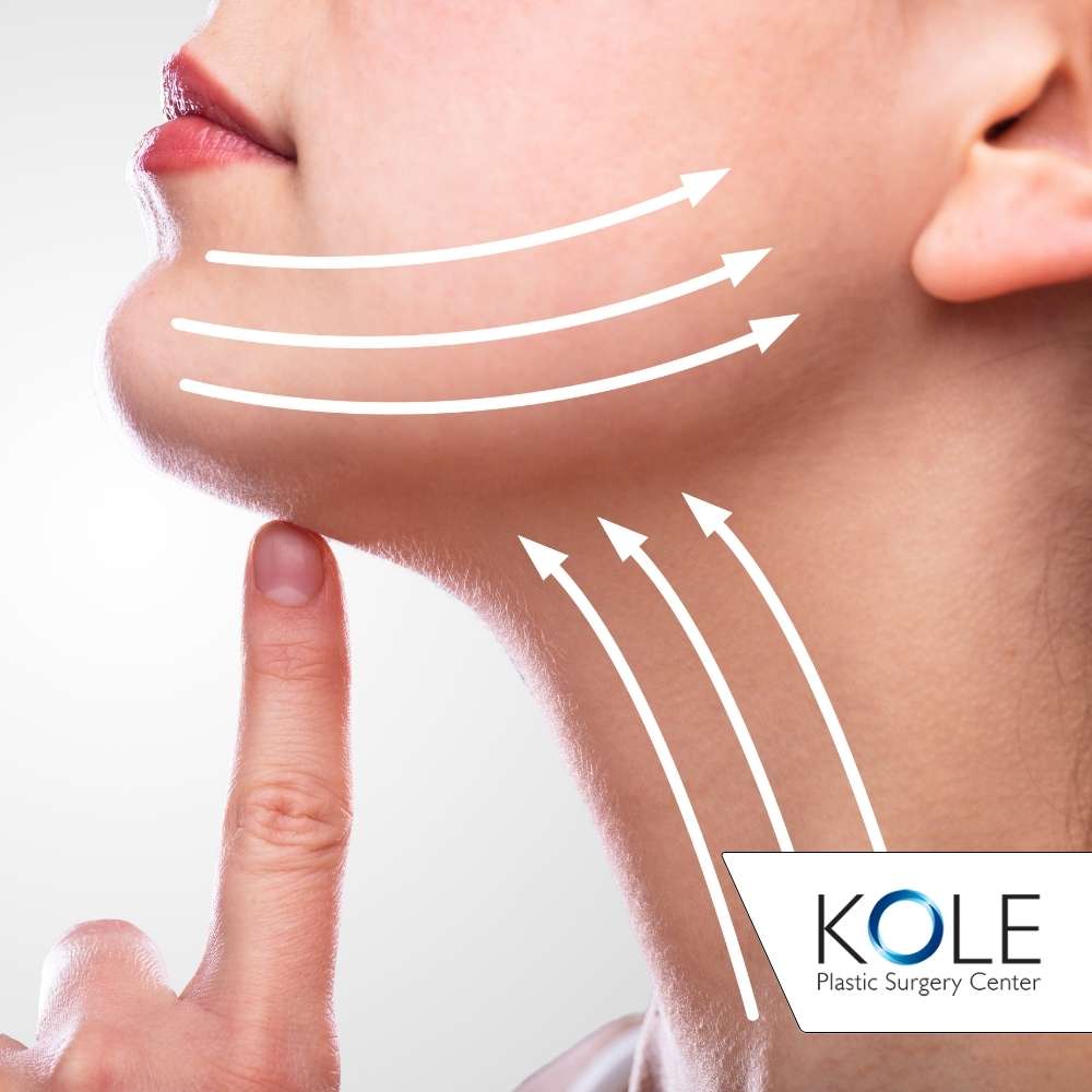 Neck Lift - Kole Plastic Surgery Bucks County