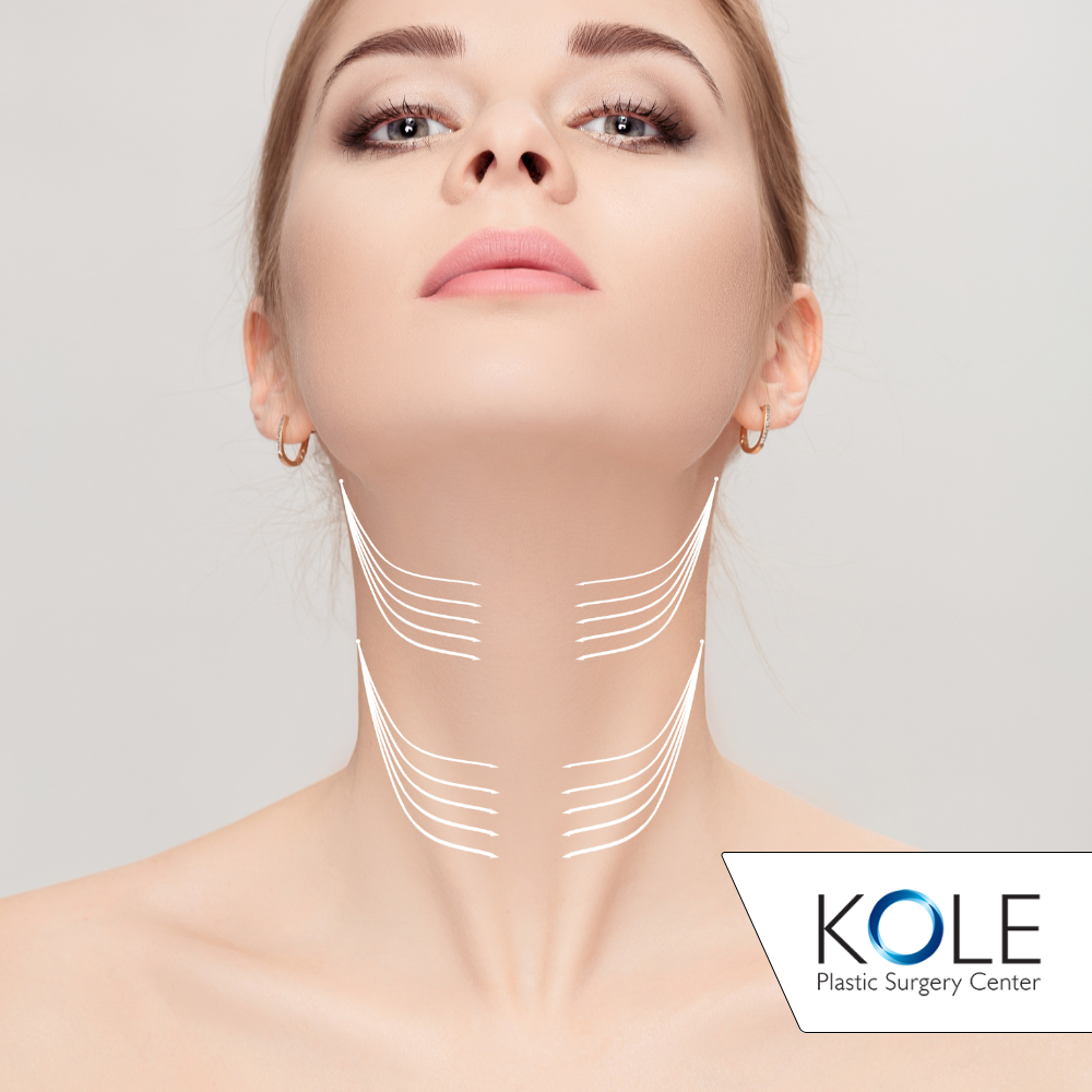an image of a woman with a marks on neck after neck lift