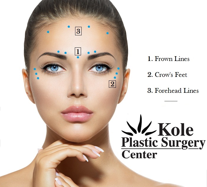 Botox - cosmetic procedure at The Kole Plastic Surgery Center