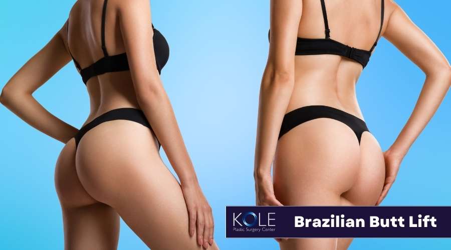 Brazilian butt lift by The Kole Plastic Surgery Center