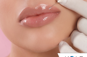 lip injection