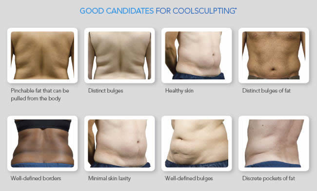 Good candidates for Coolsculpting