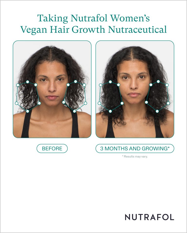 Nutrafol_126279_Pro_Before_After_Photos_Ad_Templates
Before and After