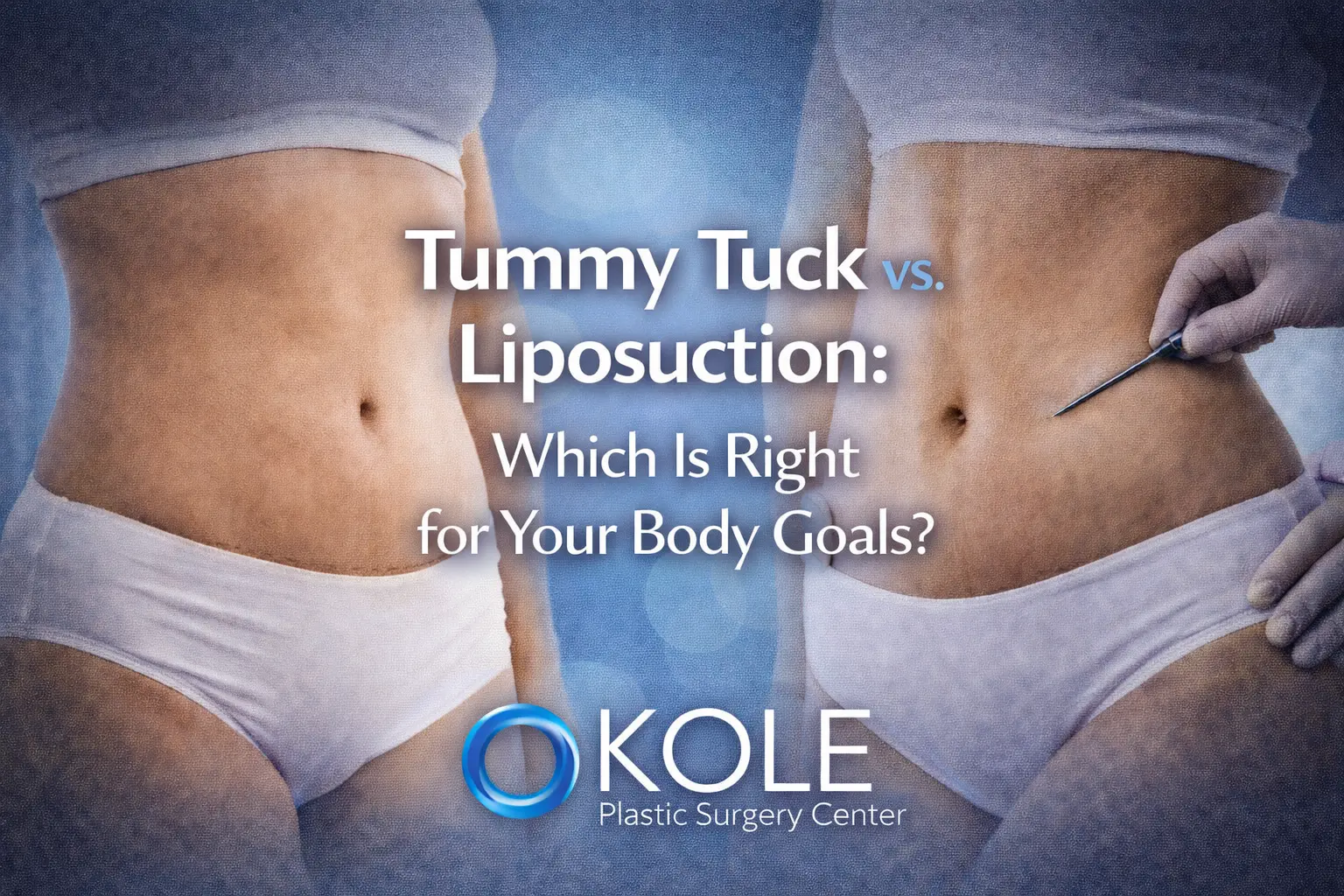 tummy tuck vs. liposuction